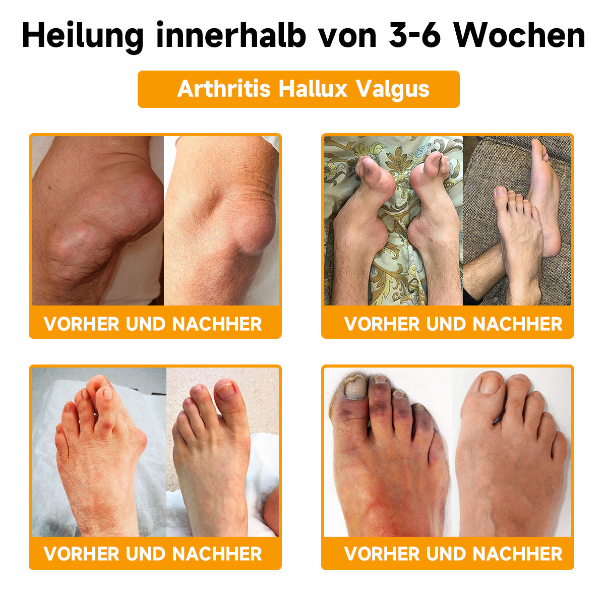 Offizieller Shop:Raindew Bienengift- und Kurkuma-Gelenk- und Knochenschmerzlinderungscreme