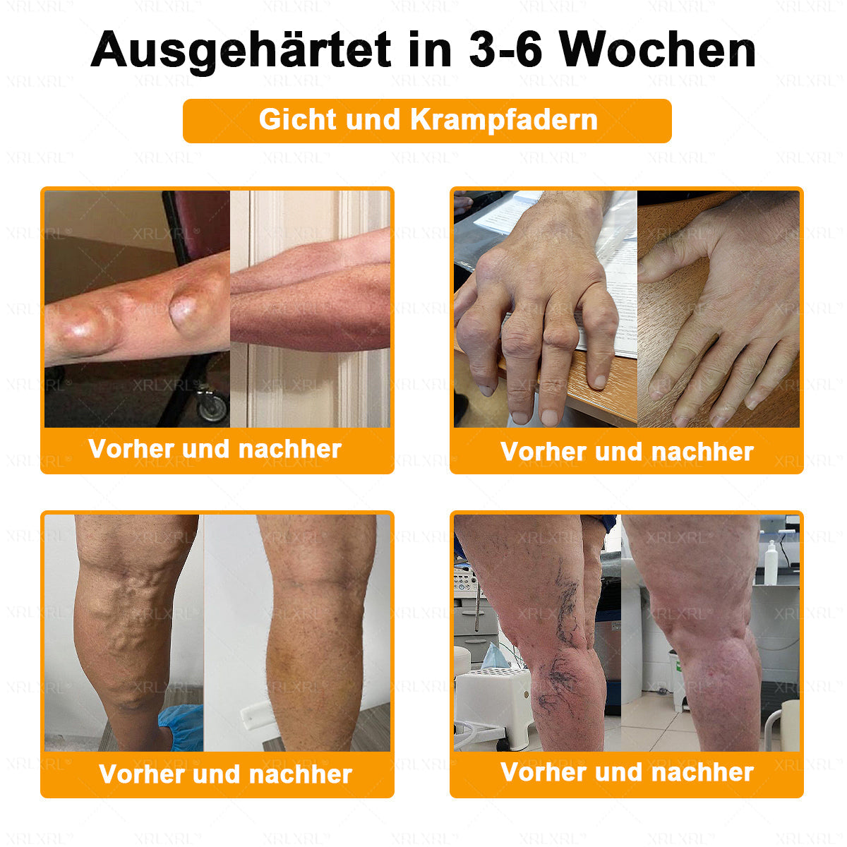 Raindew® BIENGIFT LITHOSPERMUM Schmezindeme Creme zurKnochenhelung ✨LETZTER TAG 80 % RABATT