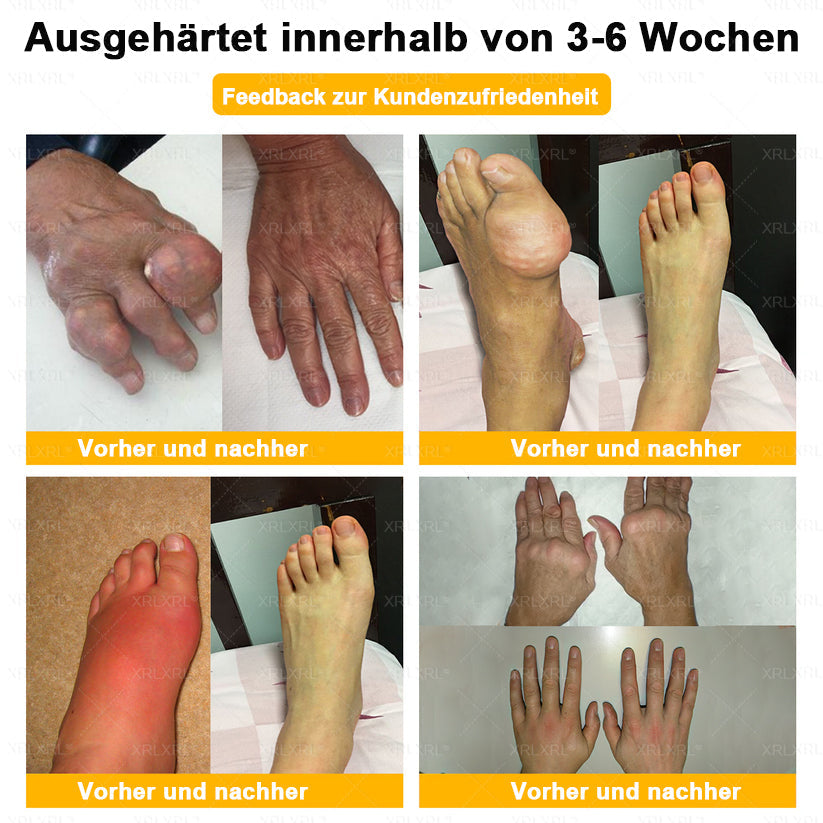 Raindew® BIENGIFT LITHOSPERMUM Schmezindeme Creme zurKnochenhelung ✨LETZTER TAG 80 % RABATT