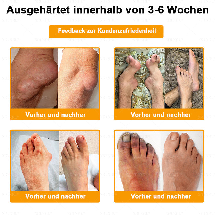 Raindew® BIENGIFT LITHOSPERMUM Schmezindeme Creme zurKnochenhelung ✨LETZTER TAG 80 % RABATT