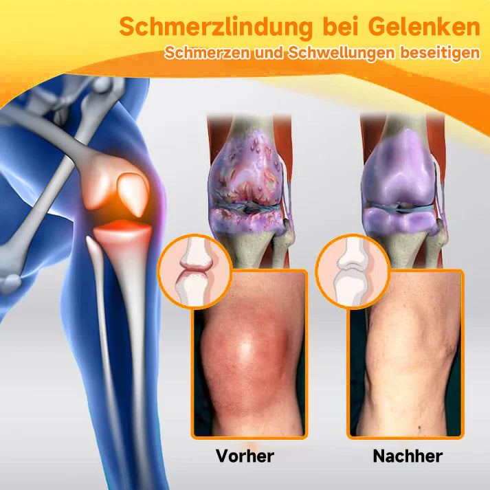 Offizieller Shop:Raindew Bienengift- und Kurkuma-Gelenk- und Knochenschmerzlinderungscreme