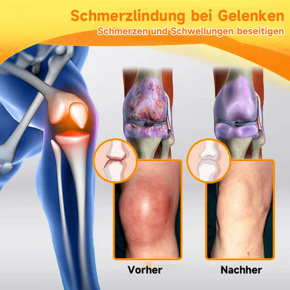 Offizieller Shop:Raindew Bienengift- und Kurkuma-Gelenk- und Knochenschmerzlinderungscreme