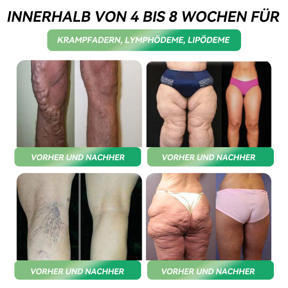 🔥Online-Apotheke🇩🇪𝐂𝐫𝐨𝐚𝐢𝐞® 𝐇𝐨𝐜𝐡𝐤𝐨𝐧𝐳𝐞𝐧𝐭𝐫𝐢𝐞𝐫𝐭𝐞 𝟑-𝐢𝐧-𝟏 𝐊𝐚𝐩𝐬𝐞𝐥𝐧🌻🌻𝐟𝐥𝙪̈𝐬𝐬𝐢𝐠 𝐳𝐮𝐦 𝐄𝐢𝐧𝐧𝐞𝐡𝐦𝐞𝐧 (𝙉𝙪𝙧 𝙚𝙞𝙣𝙚 𝘿𝙤𝙨𝙞𝙨 𝙥𝙧𝙤 𝙏𝙖𝙜, 𝙨𝙞𝙘𝙝𝙩𝙗𝙖𝙧𝙚 𝙑𝙚𝙧𝙖̈𝙣𝙙𝙚𝙧𝙪𝙣𝙜𝙚𝙣 𝙞𝙣 7 𝙏𝙖𝙜𝙚𝙣) ✅ 𝙁𝙪̈𝙧 𝙁𝙚𝙩𝙩𝙡𝙚𝙞𝙗𝙞𝙜𝙠𝙚𝙞𝙩, 𝙠𝙖𝙧𝙙𝙞𝙤𝙫𝙖𝙨𝙠𝙪𝙡𝙖̈𝙧𝙚 𝙂𝙚𝙨𝙪𝙣𝙙𝙝𝙚𝙞𝙩, 𝘿𝙞𝙖𝙗𝙚𝙩𝙚𝙨, 𝙎𝙘𝙝𝙡𝙖𝙛𝙖𝙥𝙣𝙤𝙚, 𝙂𝙚𝙡𝙚𝙣𝙠𝙥𝙧𝙤𝙗𝙡𝙚𝙢𝙚 𝙪𝙣𝙙 𝙢𝙚𝙝𝙧.