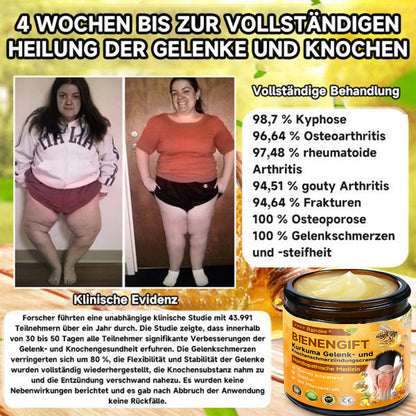 Offizieller Shop:Raindew Bienengift- und Kurkuma-Gelenk- und Knochenschmerzlinderungscreme