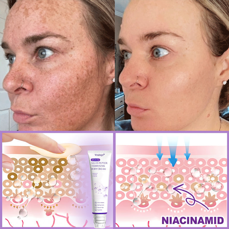 𝐏𝐮𝐫𝐞𝐥𝐨𝐫𝐚® ❤️PDRN Multi-Peptide Massaging Body Roller Cream- Anti-aging, Hydrating, Skin Firming & Lifting, Skin Repair, Even Tone, Acne and Dark Spot Treatment, Wart and Mole Removal, and Psoriasis Relief.