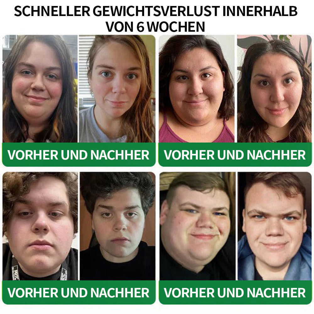 [Siehe Ergebnisse in 7 Tagen]🔔 SMGT-GLP-1 Nano Microneedle Patch & Matrixyl 3000 (Schmerzfrei, langanhaltend, behandelt Diabetes, Fettleibigkeit und Herz-Kreislauf-Erkrankungen)