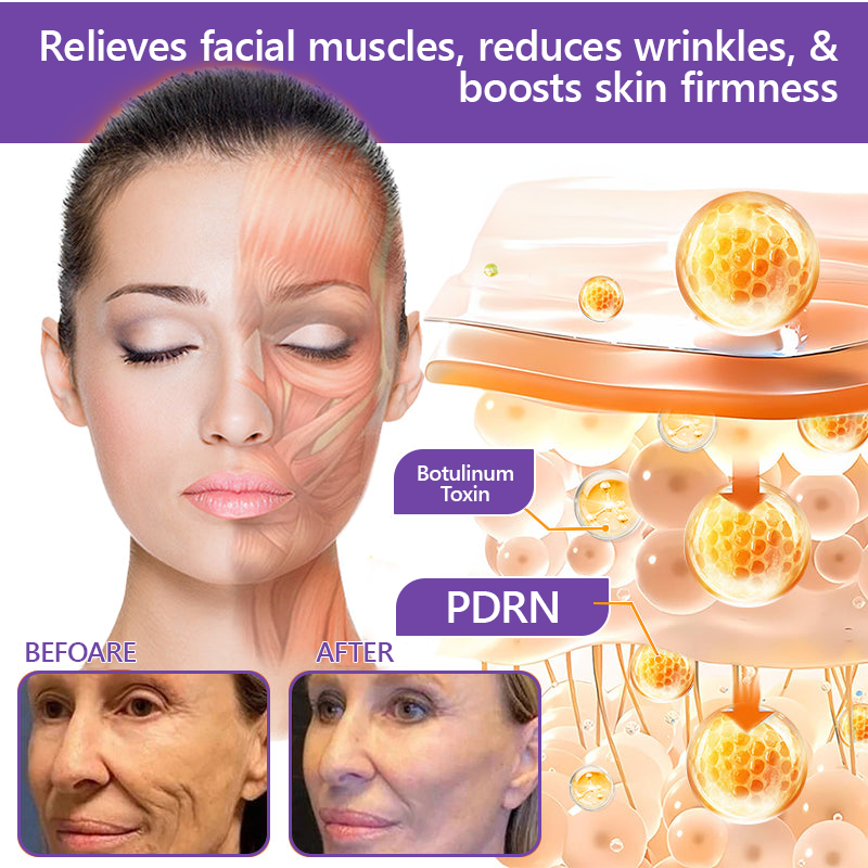 𝐏𝐮𝐫𝐞𝐥𝐨𝐫𝐚® ❤️PDRN Multi-Peptide Massaging Body Roller Cream- Anti-aging, Hydrating, Skin Firming & Lifting, Skin Repair, Even Tone, Acne and Dark Spot Treatment, Wart and Mole Removal, and Psoriasis Relief.