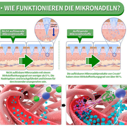 [Siehe Ergebnisse in 7 Tagen]🔔 SMGT-GLP-1 Nano Microneedle Patch & Matrixyl 3000 (Schmerzfrei, langanhaltend, behandelt Diabetes, Fettleibigkeit und Herz-Kreislauf-Erkrankungen)