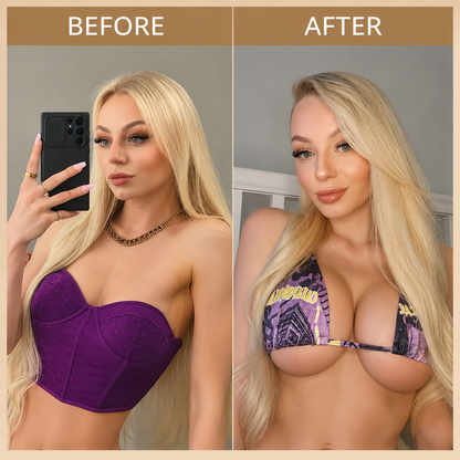 💥𝐏𝐮𝐫𝐞𝐥𝐨𝐫𝐚® 💥Targeted Breast Enhancement Advanced Nano Microneedle Patch💥💥💥