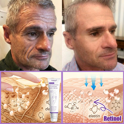 𝐏𝐮𝐫𝐞𝐥𝐨𝐫𝐚® ❤️PDRN Multi-Peptide Massaging Body Roller Cream- Anti-aging, Hydrating, Skin Firming & Lifting, Skin Repair, Even Tone, Acne and Dark Spot Treatment, Wart and Mole Removal, and Psoriasis Relief.